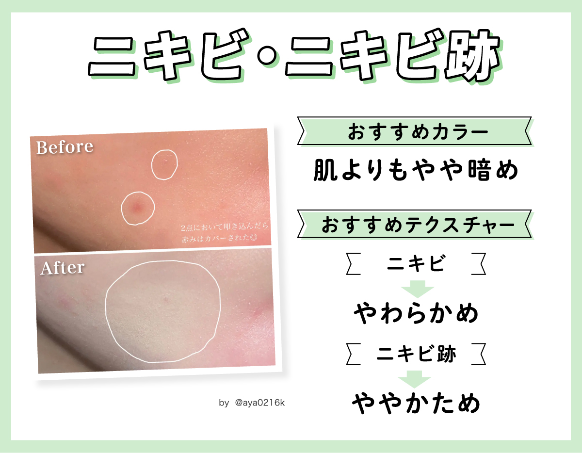 ニキビ・ニキビ跡におすすめのカラーは肌よりもやや暗め。おすすめテクスチャーはニキビにはやわらかめ、ニキビ跡にはややかためです。