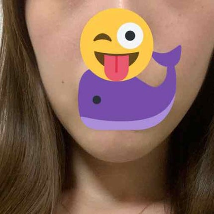 ミノン アミノモイスト 薬用アクネケア ローション/ミノン/化粧水を使ったクチコミ(2枚目)