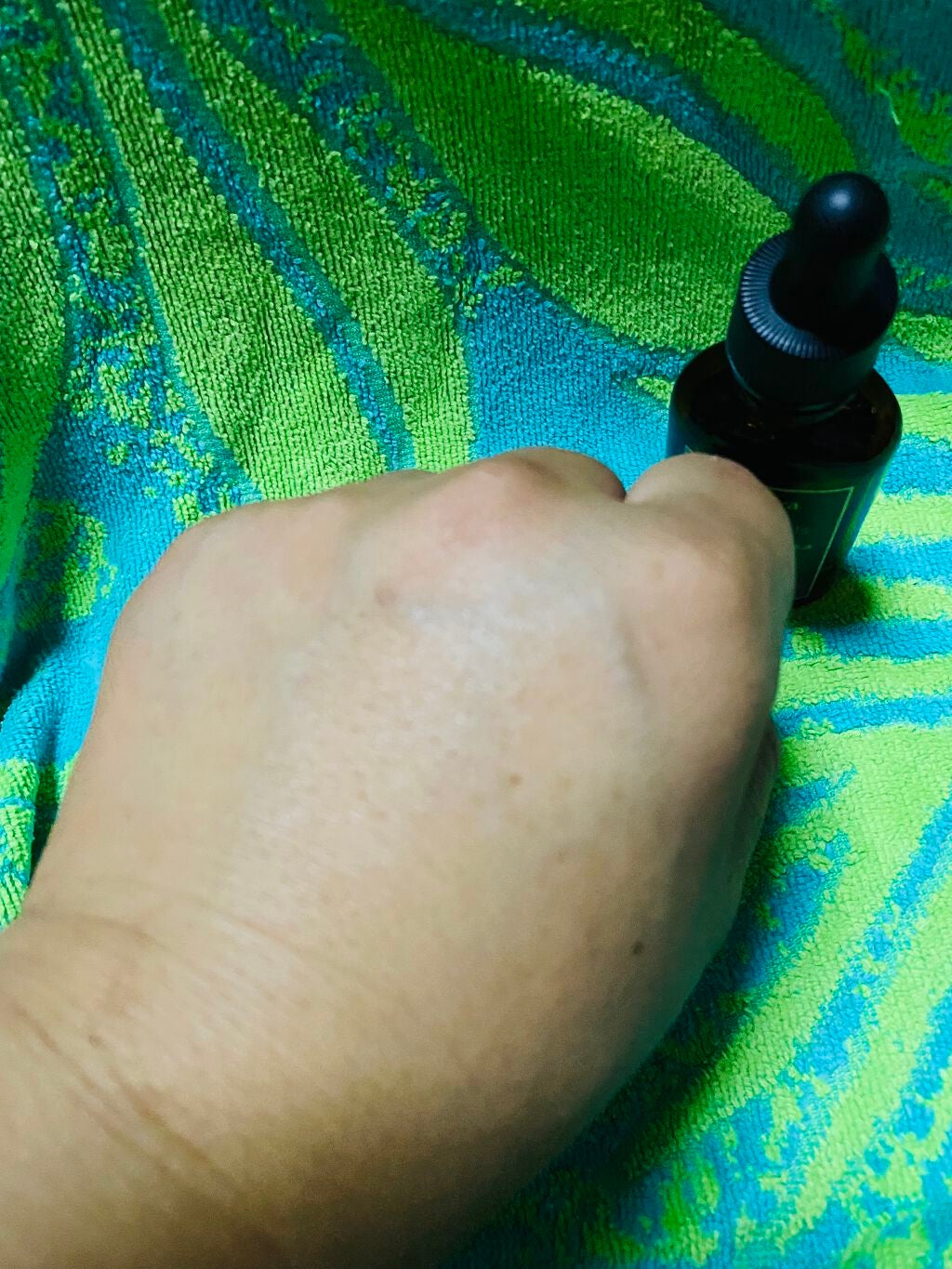 ヒト幹細胞培養エキス原液/fracora/美容液を使ったクチコミ(5枚目)