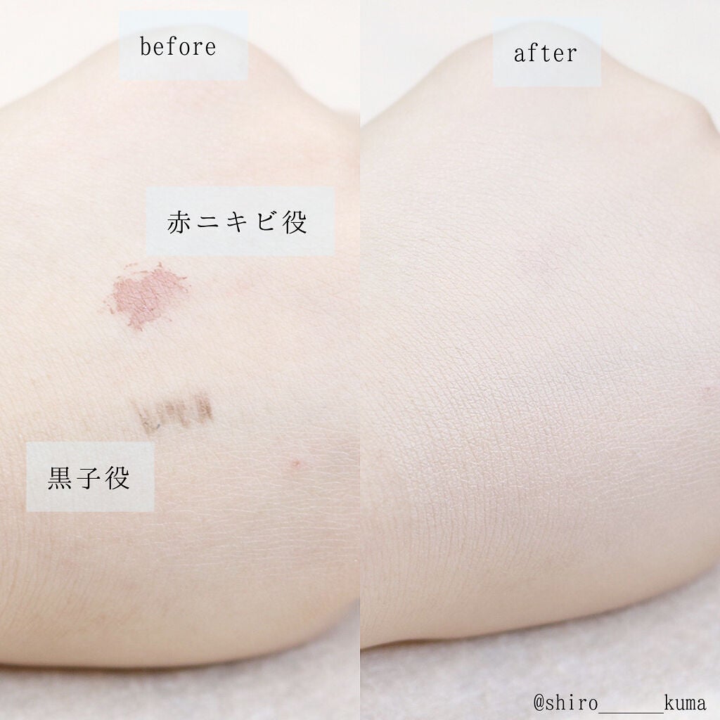 ピンクティーツリーカバークッション/APLIN/クッションファンデーションを使ったクチコミ(4枚目)