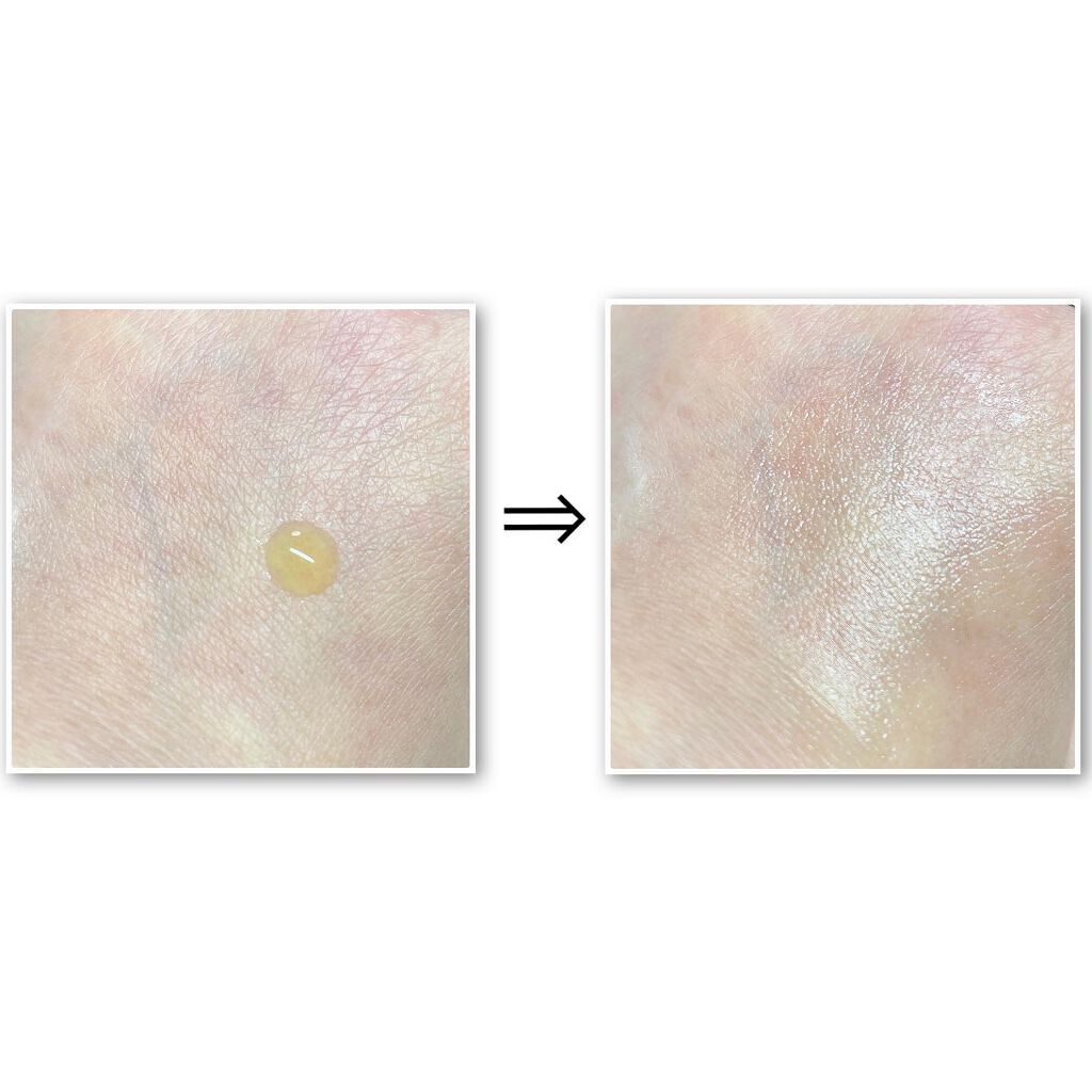 ビューティーオープナー リンクル&ホワイト/オージオ/美容液を使ったクチコミ(4枚目)