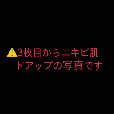 スーパーカバー コンシーラー/リンメル/クリームコンシーラーを使ったクチコミ（2枚目）