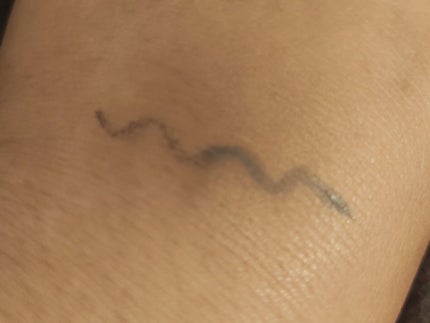 タトゥーウォータープルーフスカーコンシーラー/フォレンコス/リキッドコンシーラーを使ったクチコミ(3枚目)