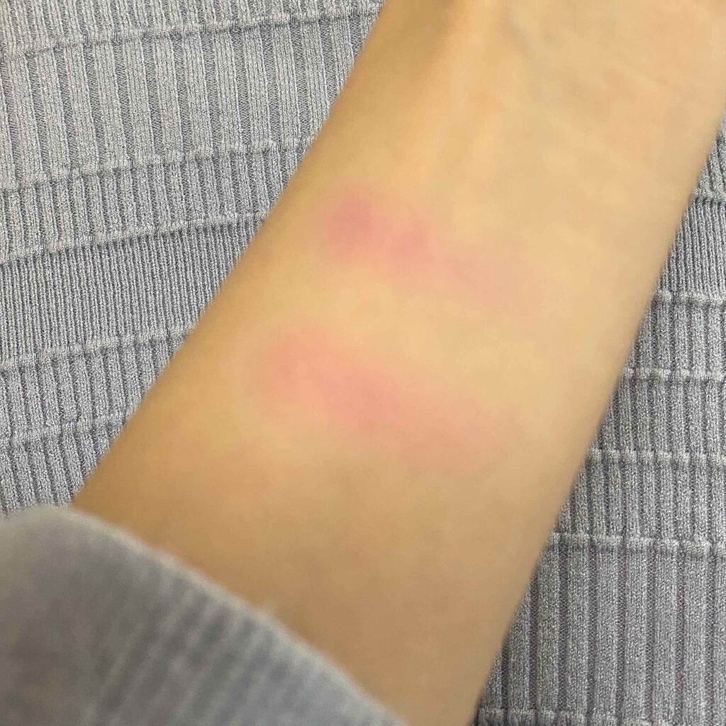 チーク ポップ/CLINIQUE/パウダーチークを使ったクチコミ(2枚目)