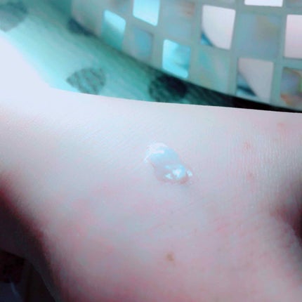 モアリップ N (医薬品)/資生堂薬品/その他を使ったクチコミ(2枚目)