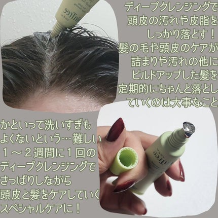 スパークリングスカルプスケーラー/ミンツリー/頭皮ケアを使ったクチコミ(2枚目)