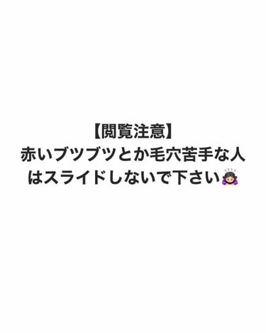 脱毛クリーム MOOMO/自然化粧品研究所/除毛クリームを使ったクチコミ（1枚目）