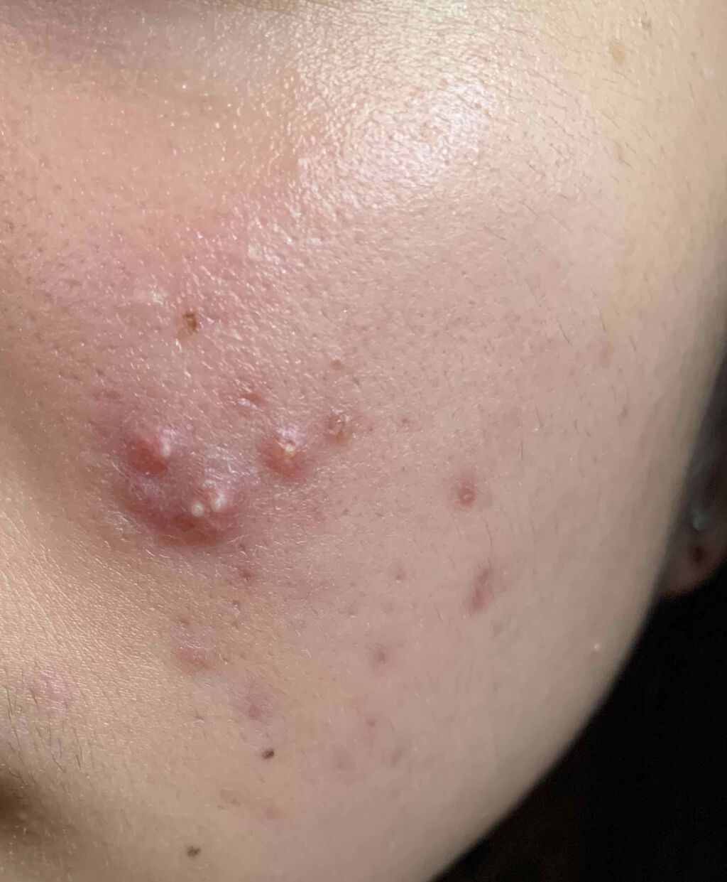 乳液・敏感肌用・しっとりタイプ/無印良品/乳液を使ったクチコミ(2枚目)