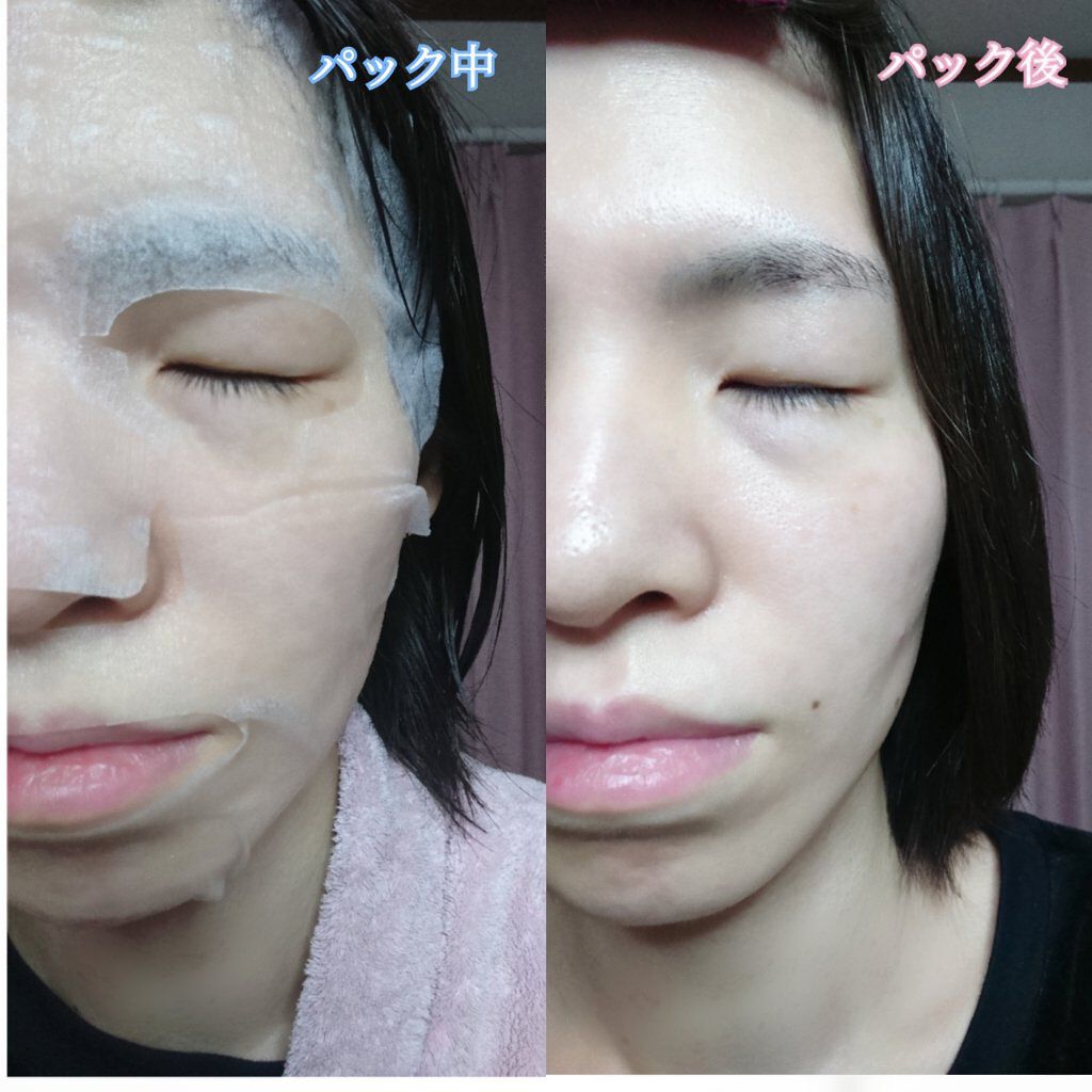オールナチュラル マスクパックDK/allNATURAL/シートマスク・パックを使ったクチコミ(9枚目)