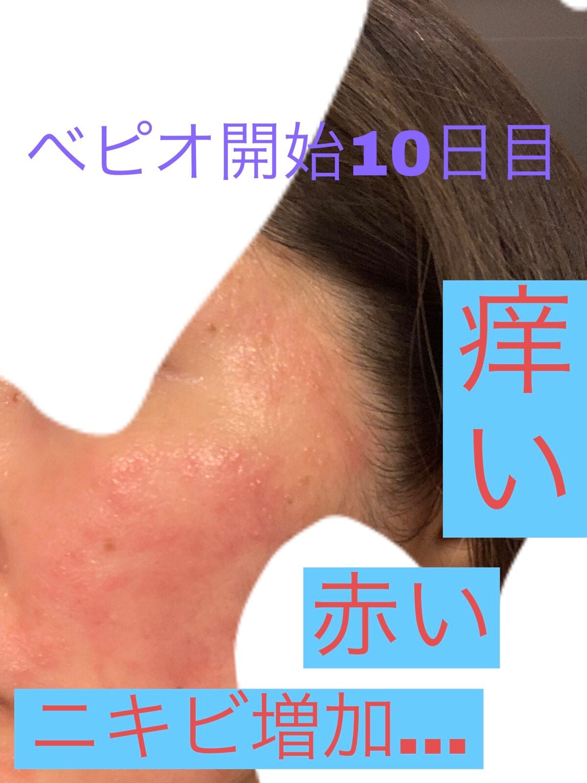 菊正宗 日本酒の化粧水 高保湿/菊正宗/化粧水を使ったクチコミ(6枚目)