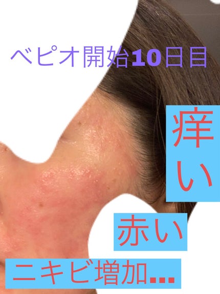 菊正宗 日本酒の化粧水 高保湿/菊正宗/化粧水を使ったクチコミ(6枚目)