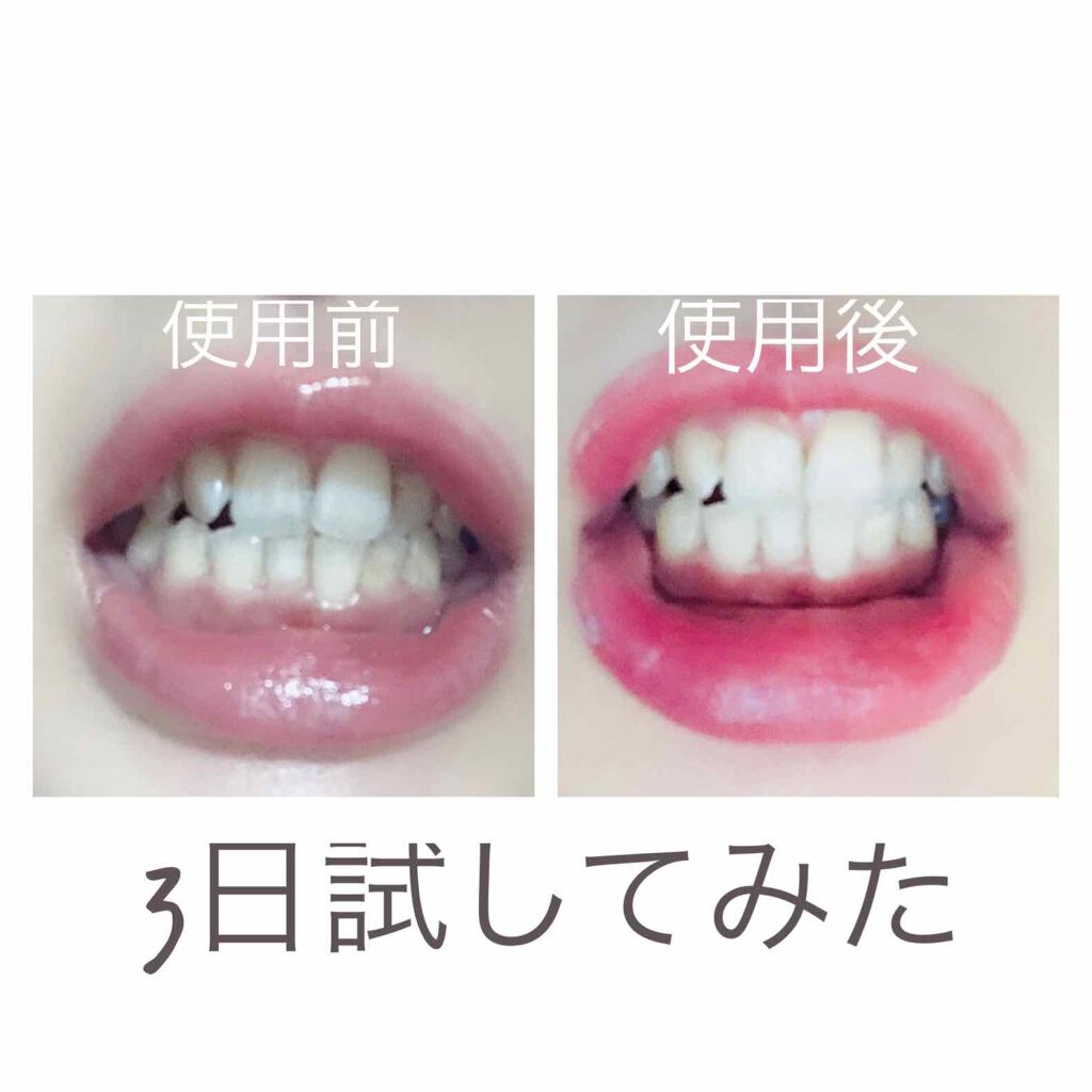 みか on LIPS 「shineSMILES-SMILEスタートキットセット内容専用..」(3枚目)