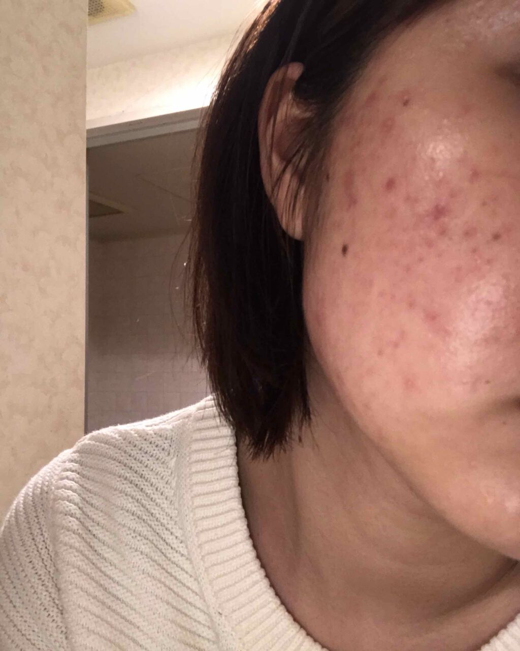 ハトムギ化粧水(ナチュリエ スキンコンディショナー R )/ナチュリエ/化粧水を使ったクチコミ(4枚目)