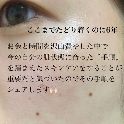 モイストフルCL ジェルクリーム/ETUDE/フェイスクリームを使ったクチコミ(3枚目)