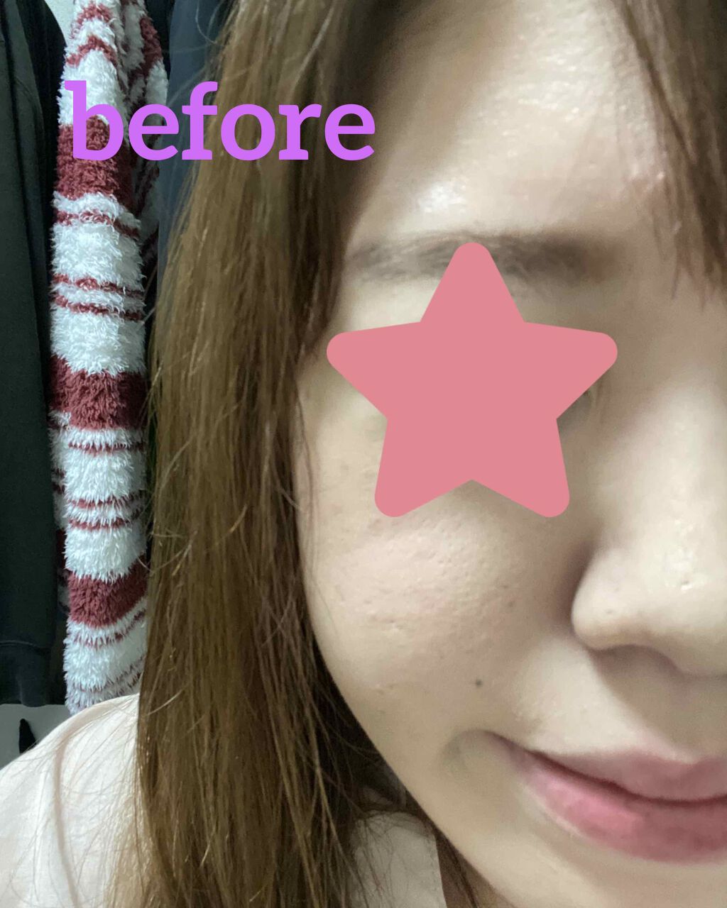 ホワイト パウダレスト/ALBION/パウダーファンデーションを使ったクチコミ（2枚目）