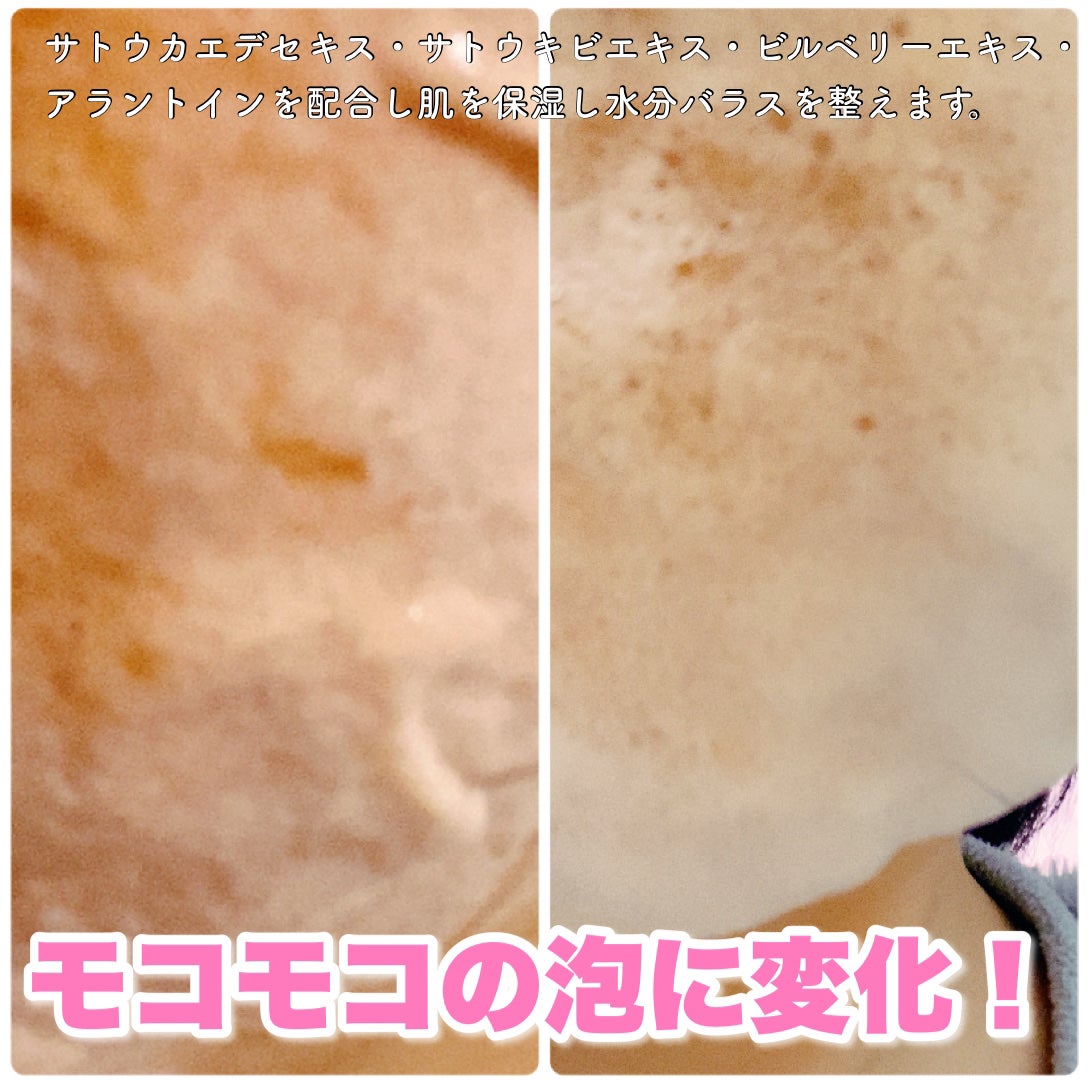 OSEQUE DUAL SKINCARE BUBBLE MASK/OSEQUE/シートマスク・パックを使ったクチコミ(3枚目)