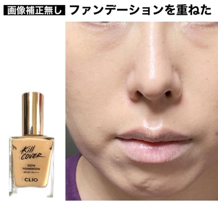 デュイセル ターンオンクリーム/DEWYCEL/フェイスクリームを使ったクチコミ(5枚目)