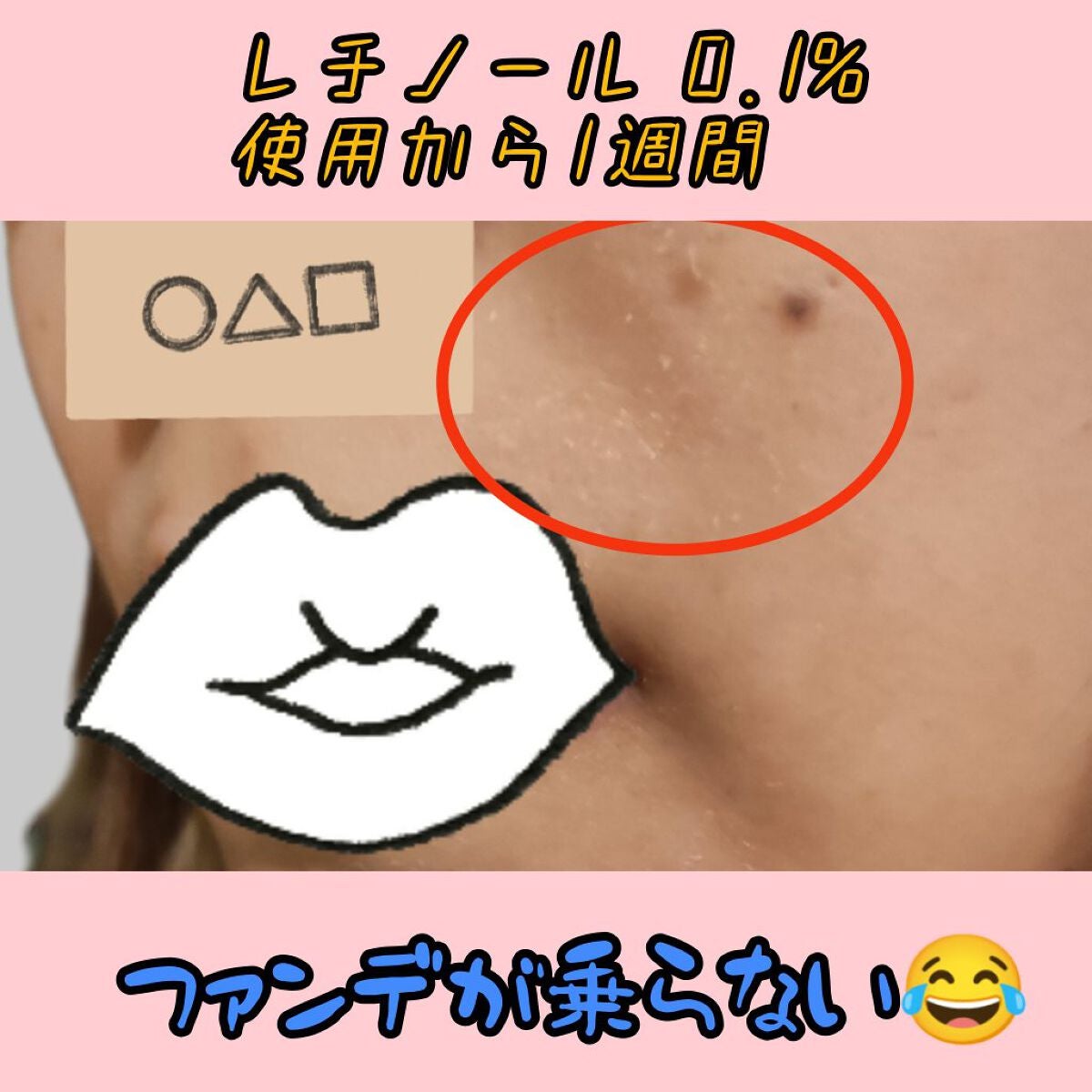 レチノールインテンシブ アドバンスドトリプルアクションアイクリーム/SOME BY MI/アイケア・アイクリームを使ったクチコミ(1枚目)