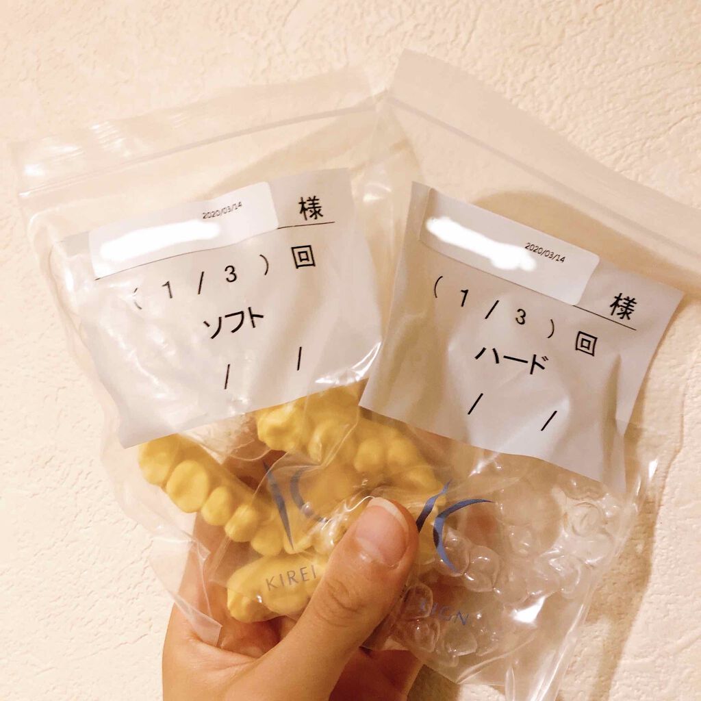 マウスピース矯正/その他を使ったクチコミ（3枚目）