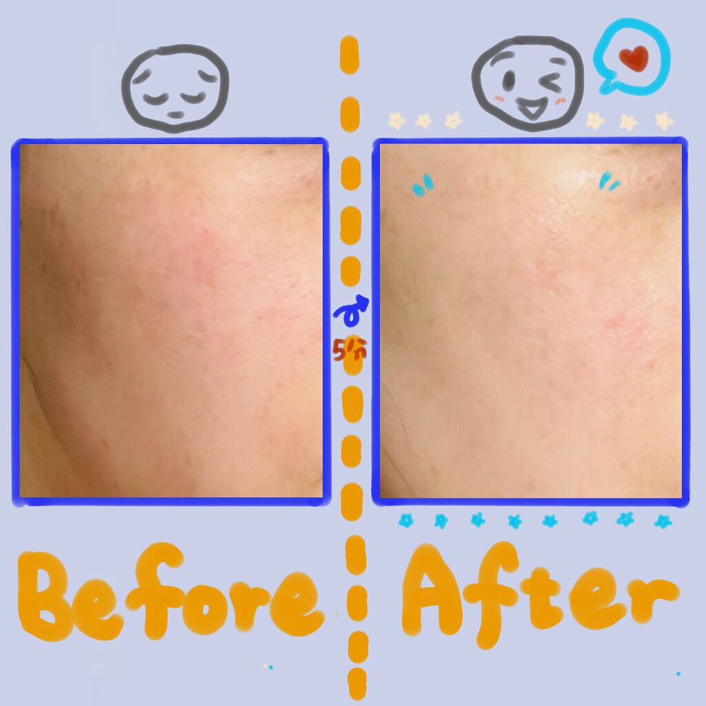 オーガニアンス ウォータリー エッセンス/primera/化粧水を使ったクチコミ(3枚目)