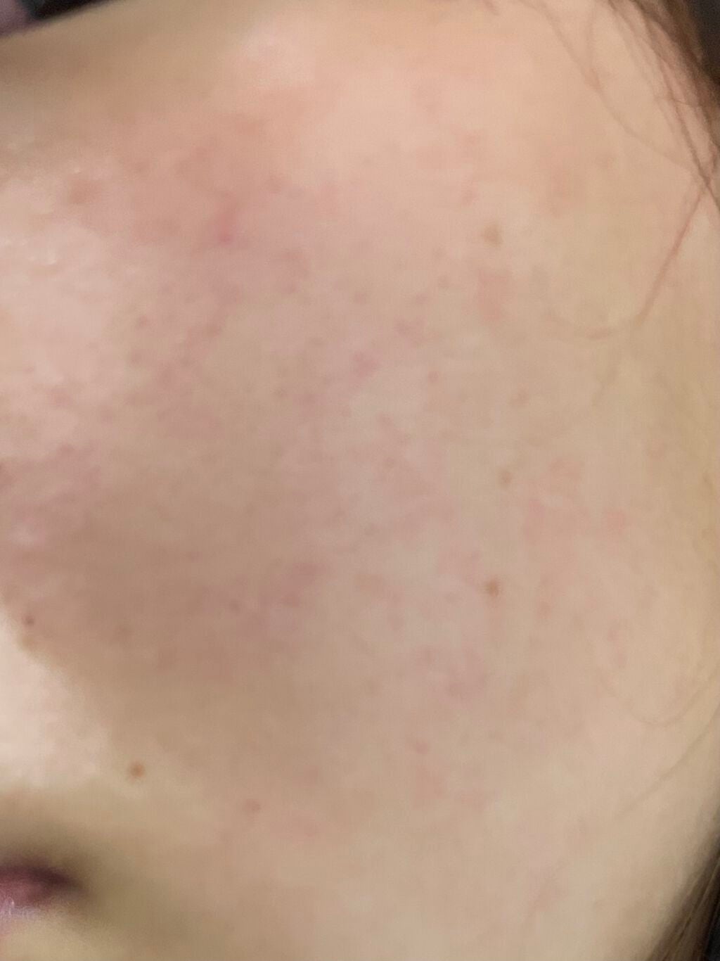 詩乃 on LIPS 「こんばんわ😌詩乃です!今日、初投稿させていただきます!最近、肌..」(3枚目)