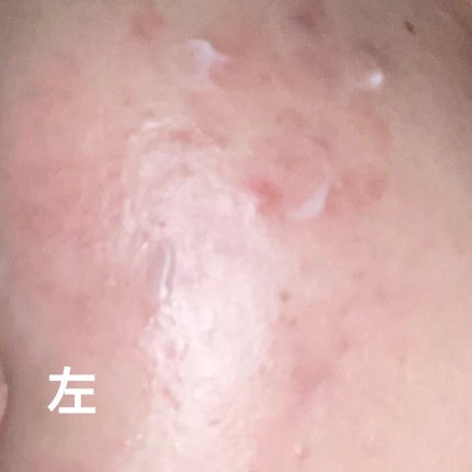 潤浸保湿 フェイスクリーム/キュレル/フェイスクリームを使ったクチコミ(1枚目)