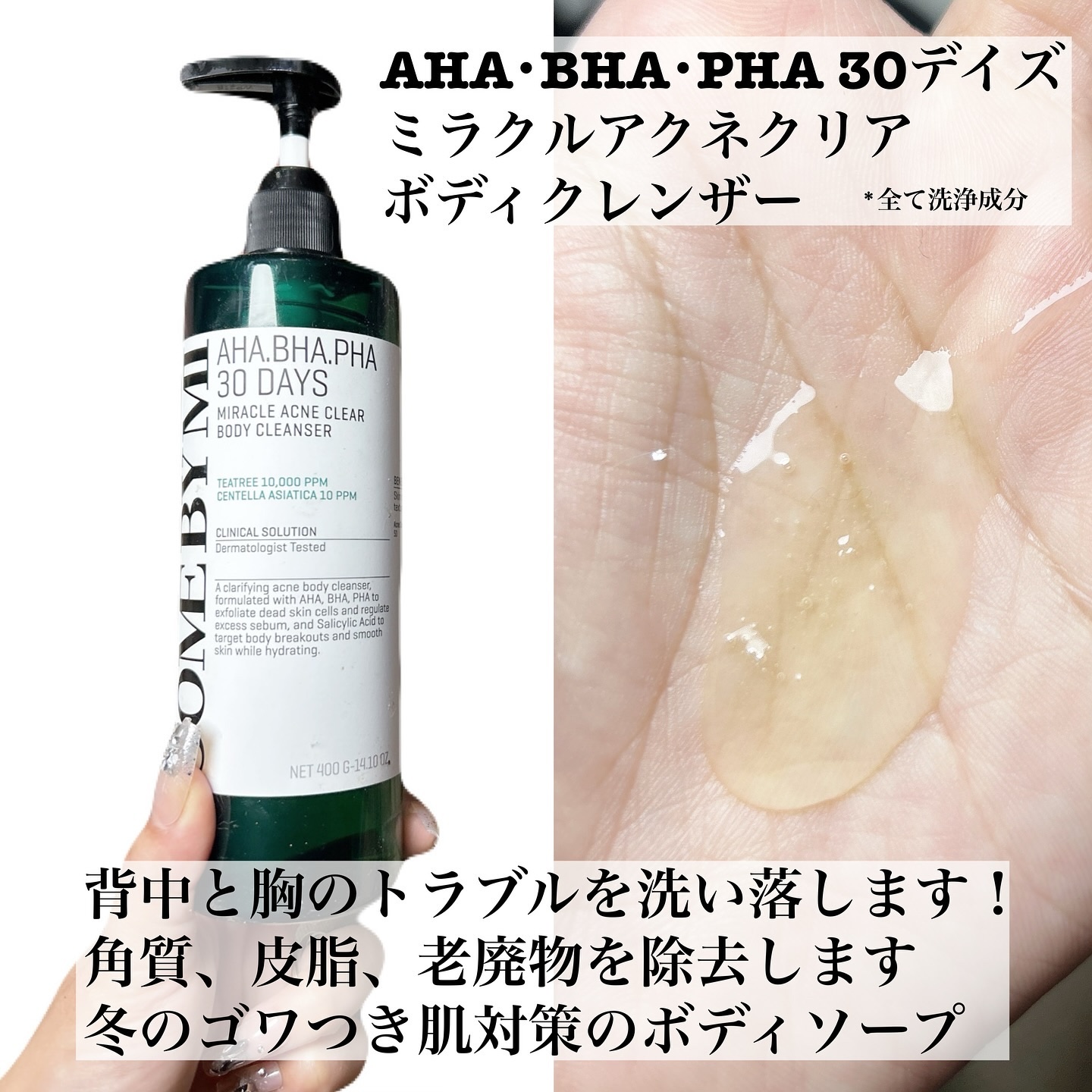 AHA·BHA·PHA 30デイズミラクルアクネボディクレンザー/SOME BY MI/ボディソープを使ったクチコミ（2枚目）