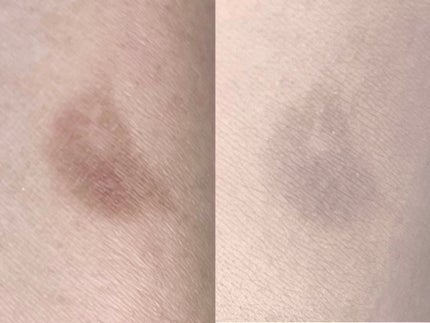 タトゥーウォータープルーフスカーコンシーラー 01M ミディアムベージュ/フォレンコス/リキッドコンシーラーの画像