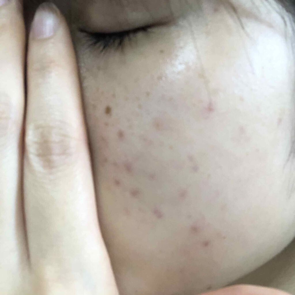 を使ったクチコミ（1枚目）