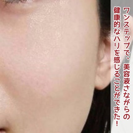 オイデルミン エッセンスローション/SHISEIDO/化粧水を使ったクチコミ(4枚目)