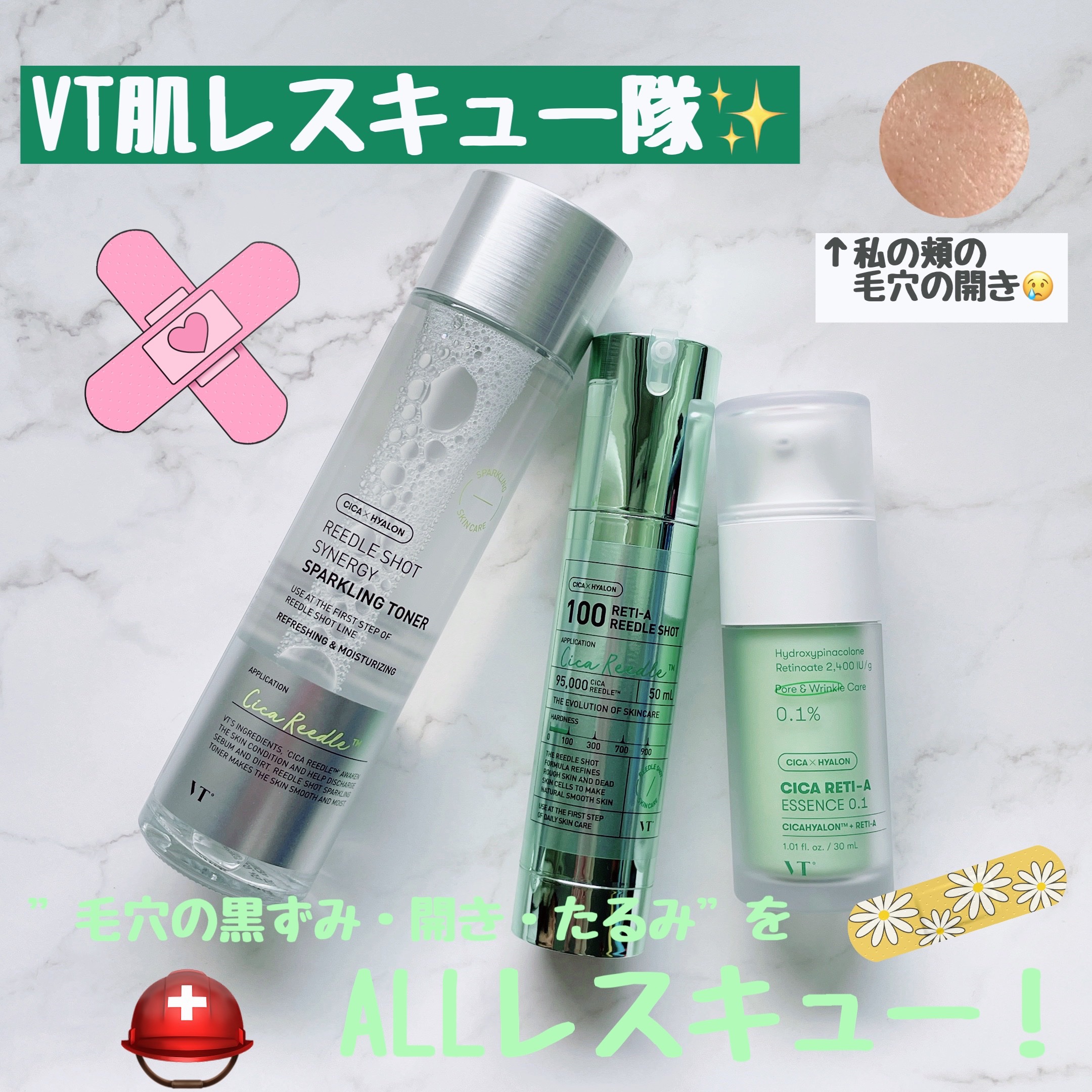 シカレチA エッセンス0.1/VT/美容液を使ったクチコミ（1枚目）