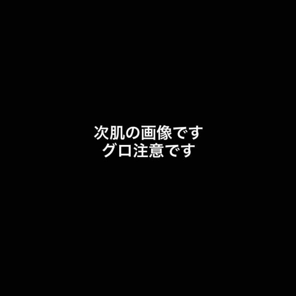 化粧水　敏感肌用　さっぱりタイプ/無印良品/化粧水を使ったクチコミ（1枚目）