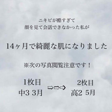 リンカ on LIPS 「《ニキビが酷すぎて悩んでた私がここまで綺麗になれました！》....」（1枚目）