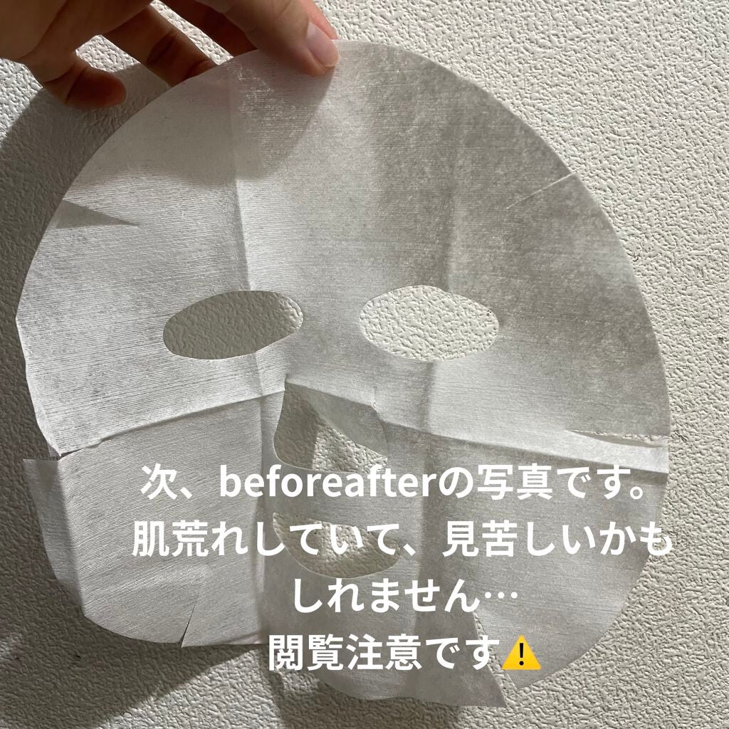 高濃度炭酸パック/17skin/シートマスク・パックを使ったクチコミ(3枚目)