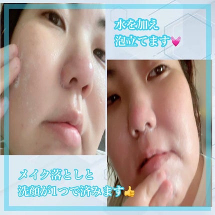 TX-アンプルクレンザー/Dr.Melaxin/美容液を使ったクチコミ(4枚目)