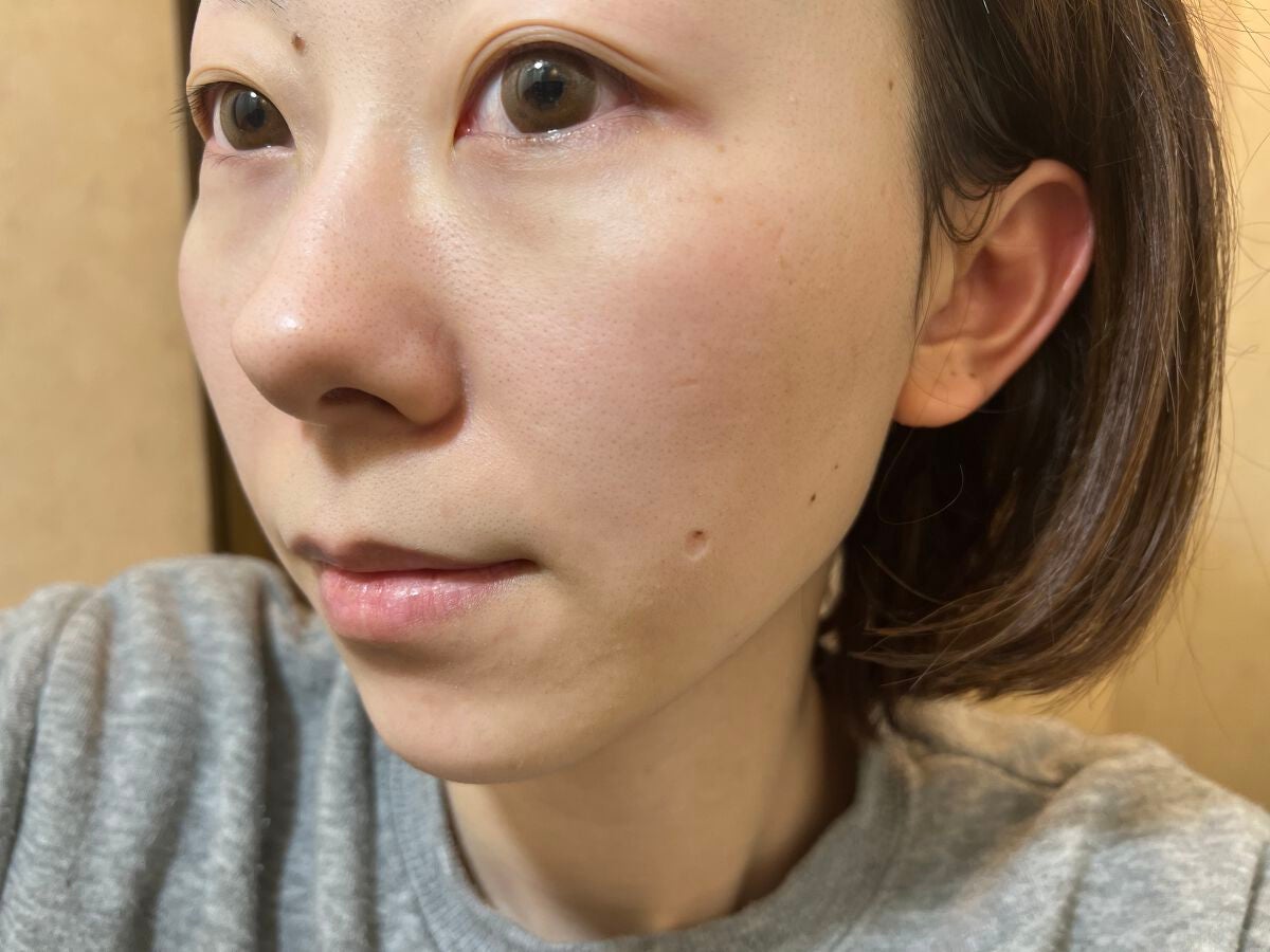 夢みるバーム アクネクリアモイスチャー/ロゼット/クレンジングバームを使ったクチコミ(8枚目)