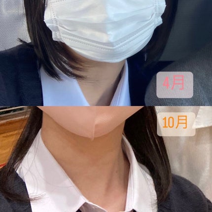 ヘアアクセルレーター レモンライムの香り/加美乃素本舗/頭皮ローションを使ったクチコミ(2枚目)