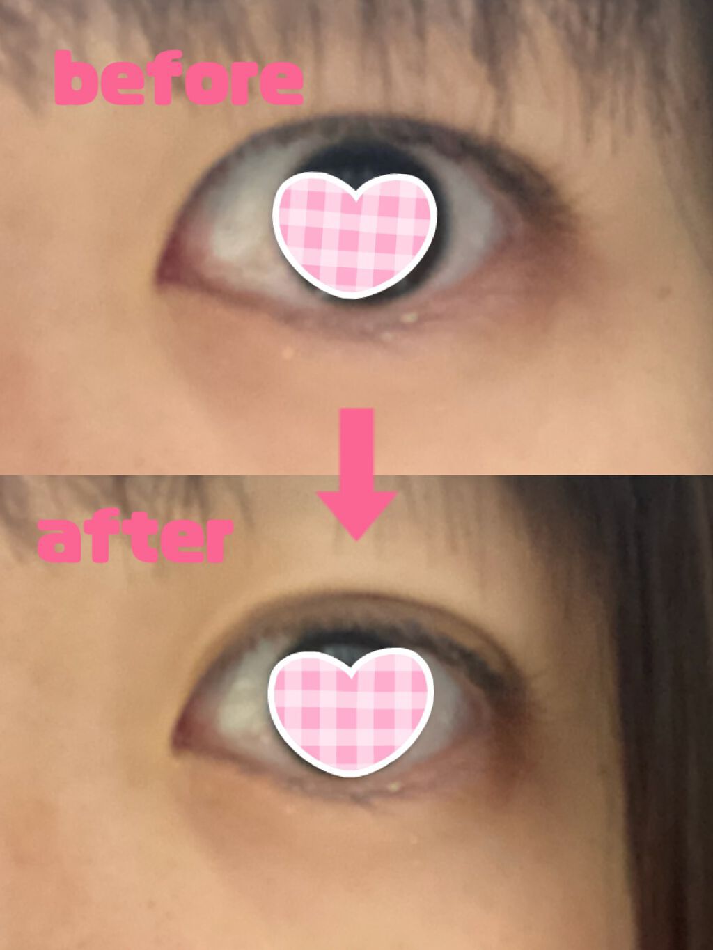 TWOOL ダブルアイリッドグルー/SHOBIDO/二重まぶた用アイテムを使ったクチコミ(7枚目)