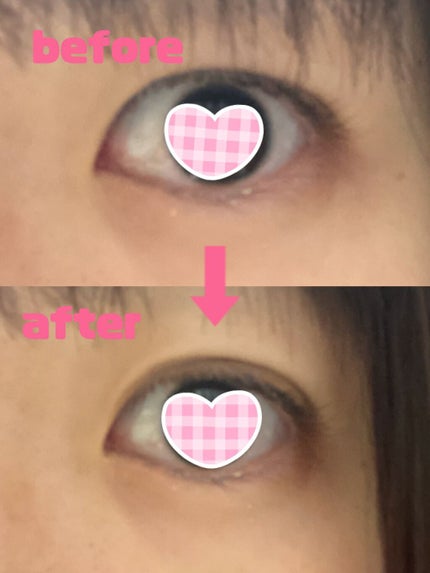 TWOOL ダブルアイリッドグルー/SHOBIDO/二重まぶた用アイテムを使ったクチコミ(7枚目)