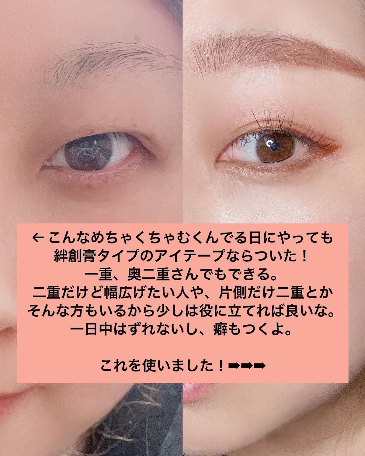 アイテープ片面(のびる)絆創膏タイプ スリム 120枚/セリア/二重まぶた用アイテムを使ったクチコミ(2枚目)