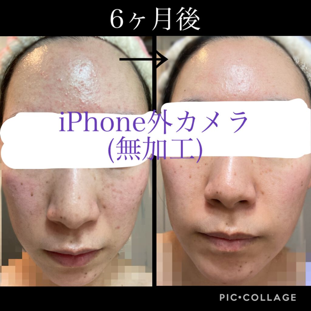 クレンジング フレッシュフォームe/IPSA/洗顔フォームを使ったクチコミ(3枚目)