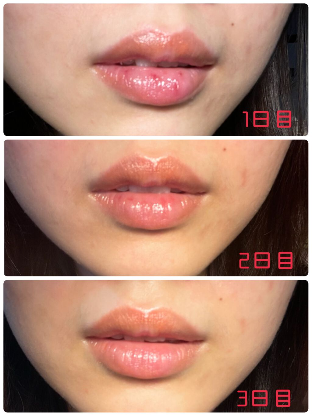 リップ ロージーリップス/ヴァセリン/リップバームを使ったクチコミ（2枚目）