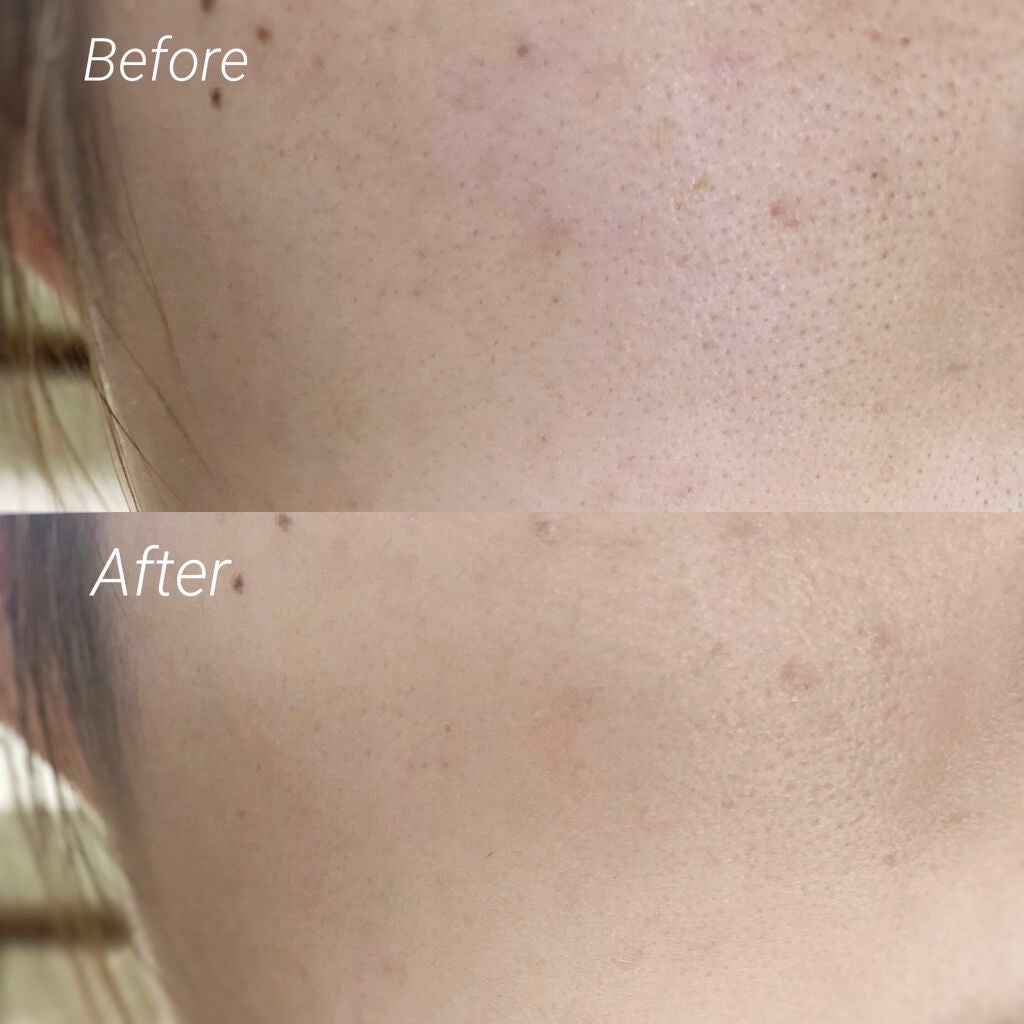 ピンクティーツリーカバークッション/APLIN/クッションファンデーションを使ったクチコミ(4枚目)