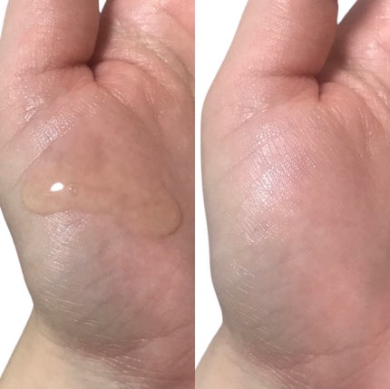 ドクダミ+ティーツリーエキスセラム/MARY&MAY/美容液を使ったクチコミ(4枚目)