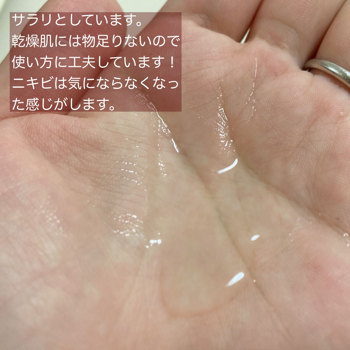 ドクダミ 77 スージングトナー/Anua/化粧水を使ったクチコミ(2枚目)