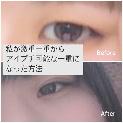 オロナインH軟膏 (医薬品)/オロナイン/その他を使ったクチコミ(1枚目)