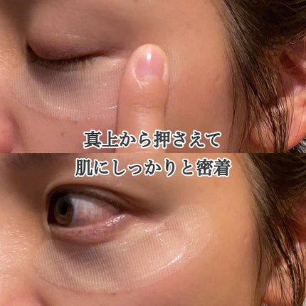 リクエス コンセントレート チャージ パッチ/クラブ/シートマスク・パックを使ったクチコミ(2枚目)