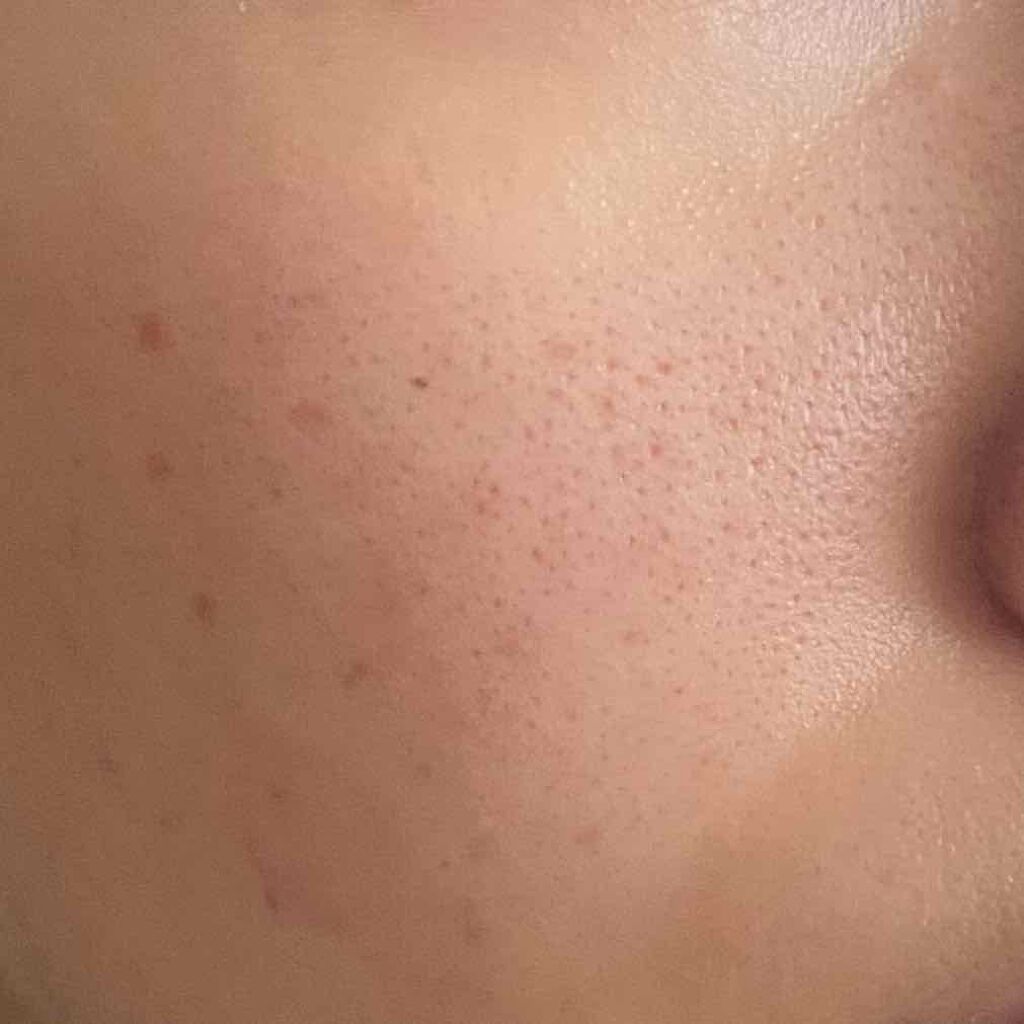 ハトムギ化粧水(ナチュリエ スキンコンディショナー R )/ナチュリエ/化粧水を使ったクチコミ(3枚目)