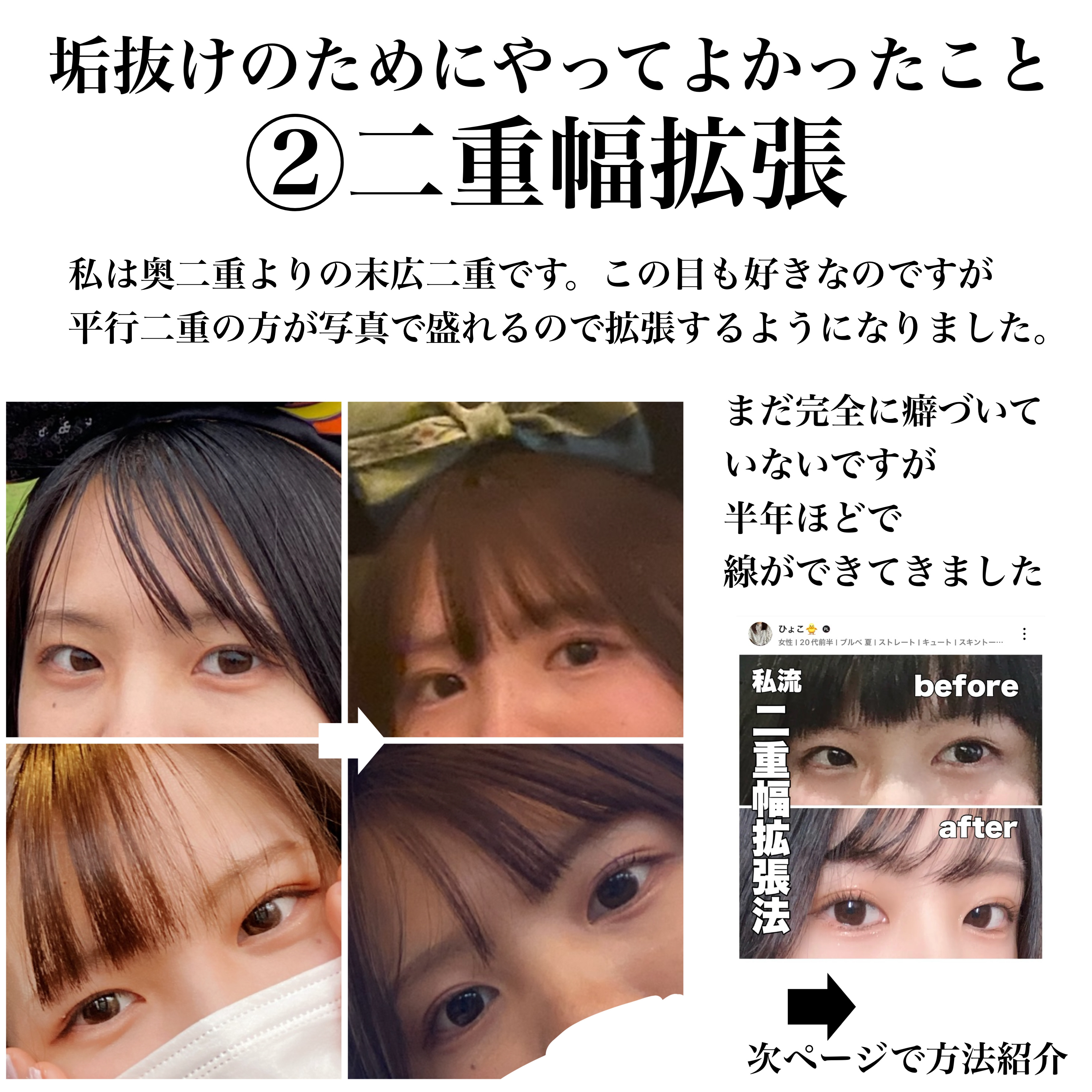 シェーディングパウダー/キャンメイク/シェーディングを使ったクチコミ（3枚目）