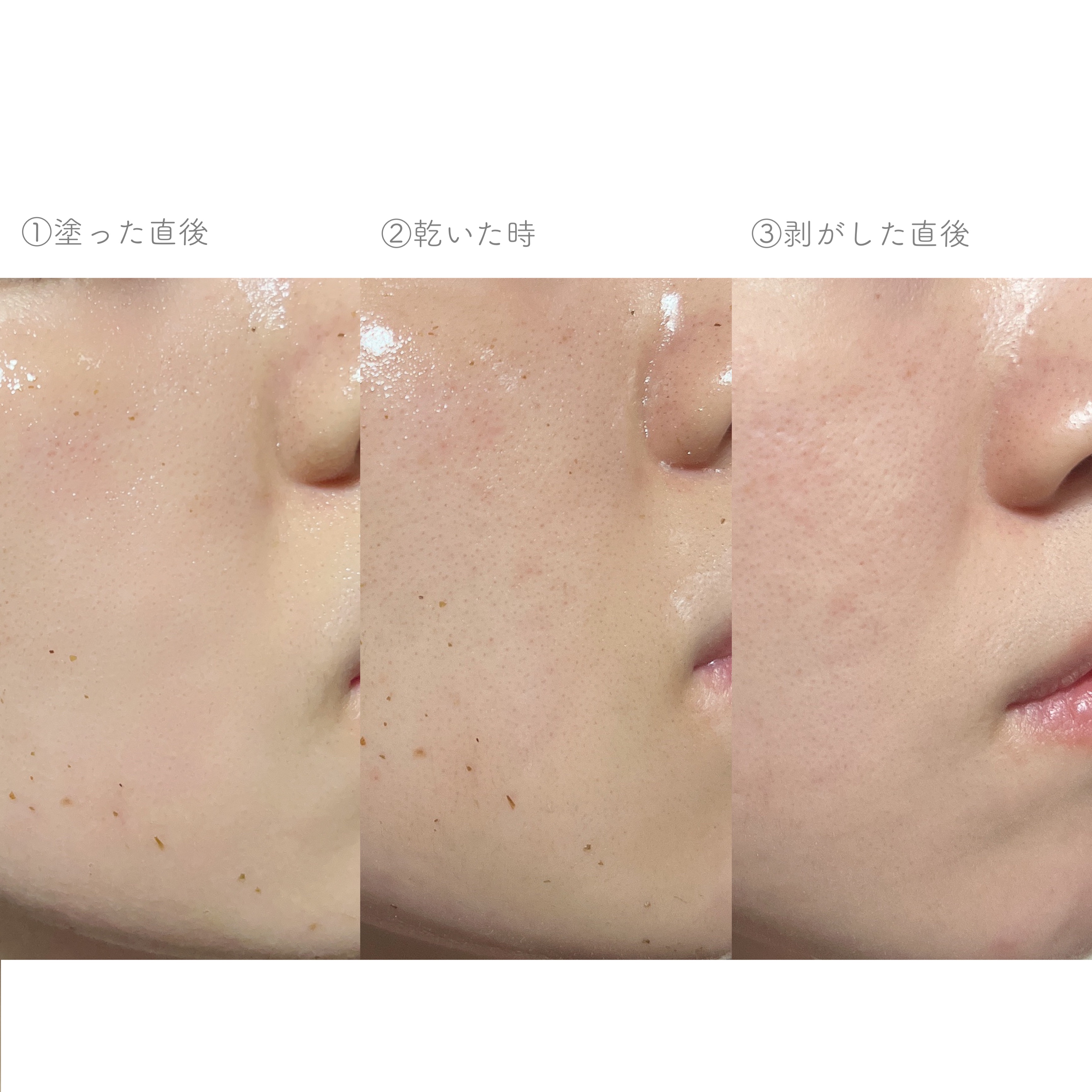 REAL CICA PEEL OFF PACK/Aetem /シートマスク・パックを使ったクチコミ（3枚目）